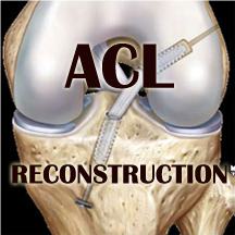 b -acl