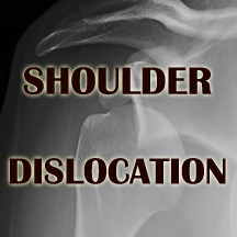 b-shoulder dislocation