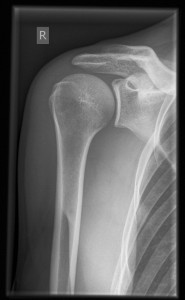 Shoulder Xray Positioning - DOCJOINTS//DR SUJIT JOS//Total joint